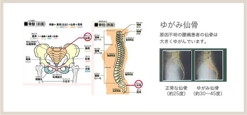 腰痛・ギックリ腰